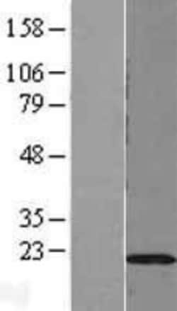 Novus Biologicals&trade;&nbsp;DUSP22 Overexpression Lysate