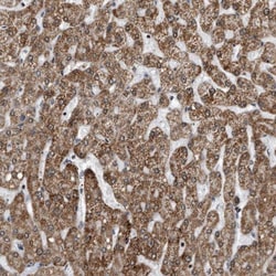 DUSP22 Antibody, Novus Biologicals 0.1mL; Unlabeled:Antibodies, Polyclonal