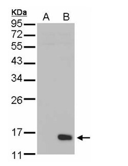 DUSP23 Antibody, Novus Biologicals 0.1mL; Unlabeled:Antibodies, Polyclonal