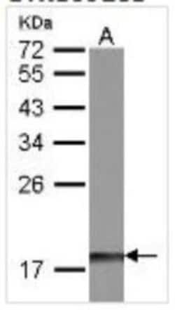 DUSP26 Antibody, Novus Biologicals 0.1mL; Unlabeled:Antibodies, Polyclonal