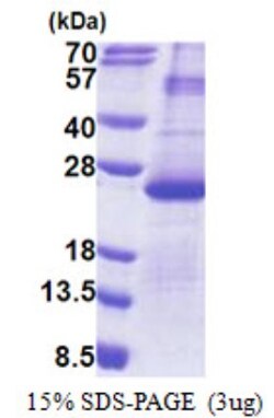 Novus Biologicals&trade;&nbsp;Recombinant Human DUSP26 His Protein