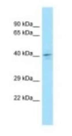 DUSP4 Antibody, Novus Biologicals:Antibodies:Primary Antibodies