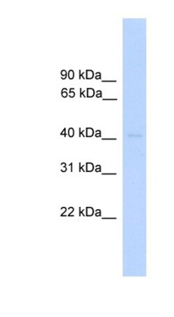 DUSP5 Antibody, Novus Biologicals:Antibodies:Primary Antibodies