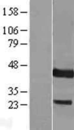 Novus Biologicals&trade;&nbsp;DUSP9 Overexpression Lysate