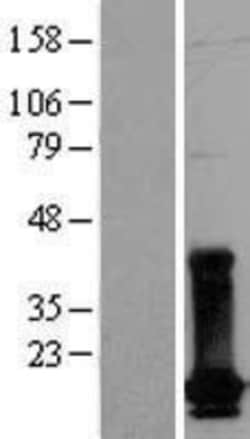 Novus Biologicals&trade;&nbsp;dUTPase Overexpression Lysate