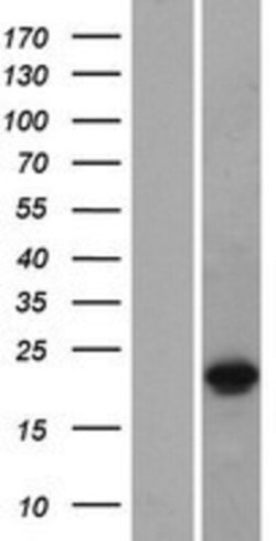 Novus Biologicals DUX3 Overexpression Lysate 0.1mg:Protein Analysis Reagents,