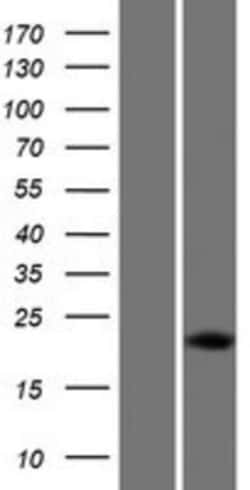 Novus Biologicals&trade;&nbsp;DUX5 Overexpression Lysate