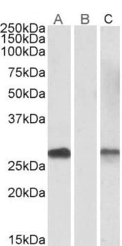 DYDC1 Antibody, Novus Biologicals 0.1mg; Unlabeled:Antibodies, Polyclonal