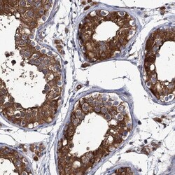 DYDC1 Antibody, Novus Biologicals 25 &mu;L | Buy Online | Novus Biologicals | Fisher Scientific