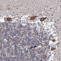 DYDC1 Antibody, Novus Biologicals:Antibodies:Primary Antibodies