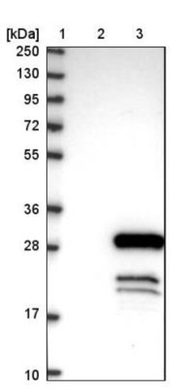 DYDC1 Antibody, Novus Biologicals 25 &mu;L | Buy Online | Novus Biologicals | Fisher Scientific