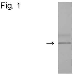 DYKDDDDK Epitope Tag Antibody, Novus Biologicals:Antibodies:Primary Antibodies