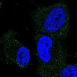 DYM Antibody, Novus Biologicals:Antibodies:Primary Antibodies