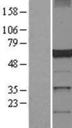 Novus Biologicals&trade;&nbsp;dynactin 4 Overexpression Lysate