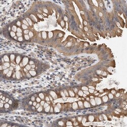 Dynactin 6 Antibody, Novus Biologicals 0.1mL; Unlabeled:Antibodies, Polyclonal