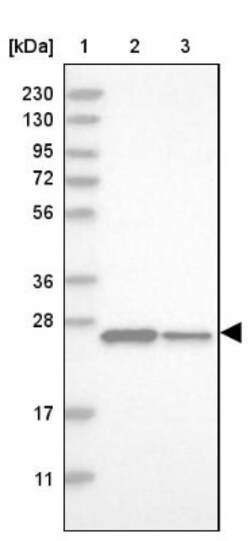 Dynactin 6 Antibody, Novus Biologicals 0.1mL; Unlabeled:Antibodies, Polyclonal
