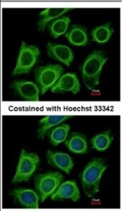 Dynactin Subunit 2/DCTN2/DCTN-50 Antibody, Novus Biologicals 0.1mL; Unlabeled:Antibodies,