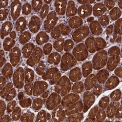 Dynactin Subunit 2/DCTN2/DCTN-50 Antibody, Novus Biologicals 0.1mL; Unlabeled:Antibodies,