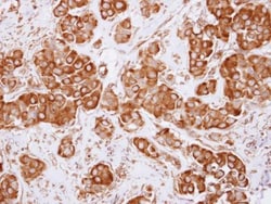 Dynactin Subunit 2/DCTN2/DCTN-50 Antibody, Novus Biologicals 0.1mL; Unlabeled:Antibodies,