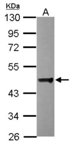 Dynactin Subunit 2/DCTN2/DCTN-50 Antibody, Novus Biologicals 0.1mL; Unlabeled:Antibodies,