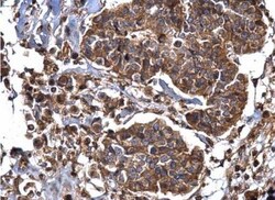 Dynamin 2 Antibody, Novus Biologicals 0.1mL; Unlabeled:Antibodies