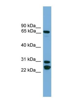 Dynein intermediate chain 2 Antibody, Novus Biologicals 20&mu;L; Unlabeled:Antibodies,
