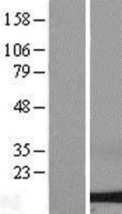 Novus Biologicals™ Dynein light chain 2 cytoplasmic Overexpression Lysate
