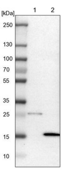 Dynein light chain 4 Antibody, Novus Biologicals 25 &mu;L; Unlabeled:Antibodies,