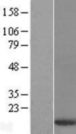 Novus Biologicals&trade;&nbsp;DYNLT3 Overexpression Lysate