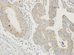 Prodynorphin/PDYN Antibody, Novus Biologicals 0.1mL; Unlabeled:Antibodies,