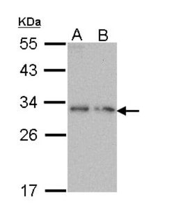 Prodynorphin/PDYN Antibody, Novus Biologicals 0.1mL; Unlabeled:Antibodies,