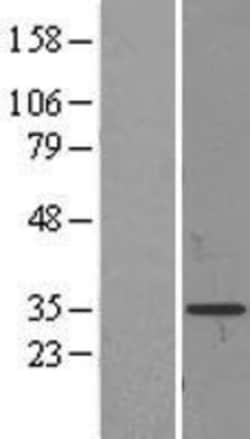 Novus Biologicals&trade;&nbsp;Prodynorphin/PDYN Overexpression Lysate