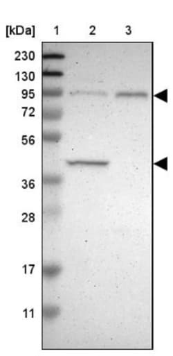 DYRK1A Antibody, Novus Biologicals:Antibodies:Primary Antibodies