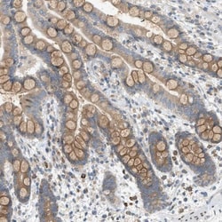 DYRK1A Antibody, Novus Biologicals 25 &mu;L; Unlabeled:Antibodies, Polyclonal