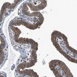 DYRK1A Antibody, Novus Biologicals:Antibodies:Primary Antibodies