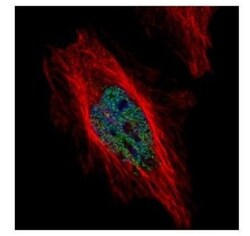 Dyrk1B Antibody, Novus Biologicals 0.1mg; Unlabeled:Antibodies, Polyclonal