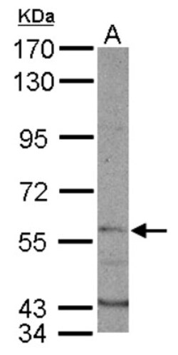 Dyrk1B Antibody, Novus Biologicals 0.1mg; Unlabeled:Antibodies, Polyclonal