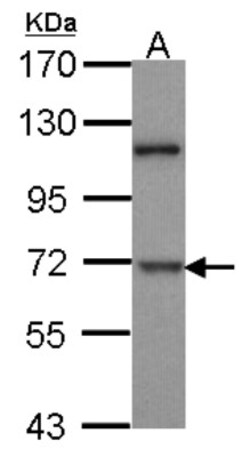 Dyrk1B Antibody, Novus Biologicals 0.1mg; Unlabeled:Antibodies, Polyclonal