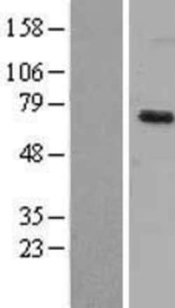 Novus Biologicals™ Dyrk1B Overexpression Lysate