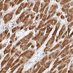 DYRK4 Antibody, Novus Biologicals 0.1mL; Unlabeled:Antibodies, Polyclonal
