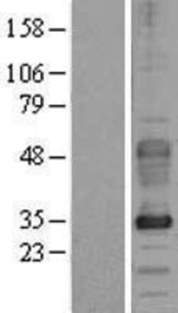 Novus Biologicals&trade;&nbsp;FXYD5/Dysadherin Overexpression Lysate