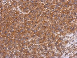 Dysbindin Antibody, Novus Biologicals 0.1mL; Unlabeled:Antibodies, Polyclonal