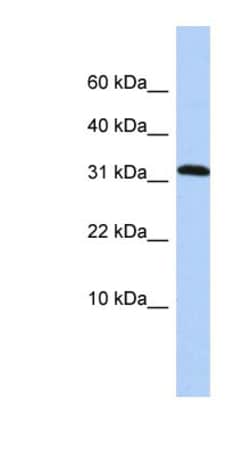 DYSFIP1 Antibody, Novus Biologicals:Antibodies:Primary Antibodies