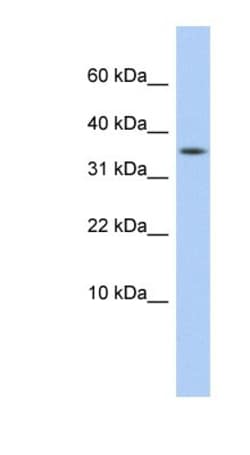 DYSFIP1 Antibody, Novus Biologicals:Antibodies:Primary Antibodies