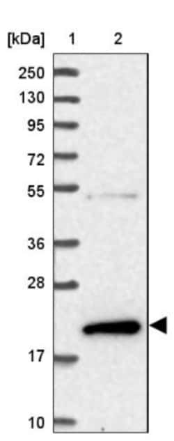 DYSFIP1 Antibody, Novus Biologicals 0.1mL; Unlabeled:Antibodies, Polyclonal