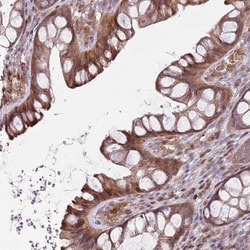 DYSFIP1 Antibody, Novus Biologicals 0.1mL; Unlabeled:Antibodies, Polyclonal