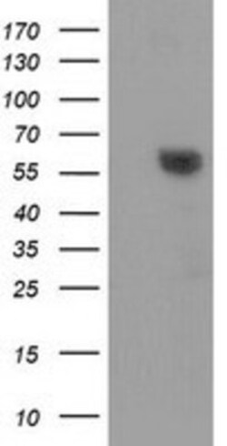 Dystrobrevin alpha Antibody (OTI1B2), Novus Biologicals 0.1mL; Unlabeled:Antibodies,