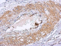 Dystrobrevin beta Antibody, Novus Biologicals 0.1mL; Unlabeled:Antibodies,