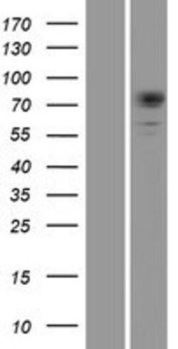 Novus Biologicals&trade;&nbsp;DMPK Overexpression Lysate