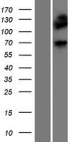Novus Biologicals&trade;&nbsp;DMPK Overexpression Lysate
